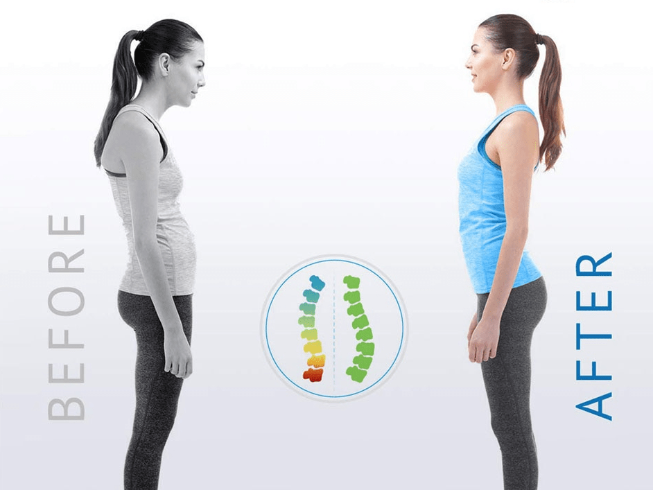 Posture Corrector - Structured DifferentlyPosture Corrector1182618_WHKV001Posture Corrector
