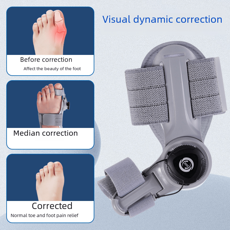 Upgraded Adjustable Bunion Corrector - Structured DifferentlyUpgraded Adjustable Bunion Corrector1773554008053579781Upgraded Adjustable Bunion Corrector